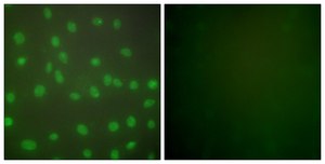 Anti-HDAC1 antibody produced in rabbit affinity isolated antibody