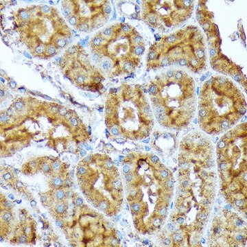 Anti-ACC1 antibody produced in rabbit