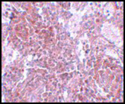 Anti-TSPAN9 antibody produced in rabbit affinity isolated antibody, buffered aqueous solution