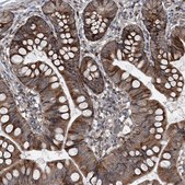 Anti-LIMK1 antibody produced in rabbit Prestige Antibodies&#174; Powered by Atlas Antibodies, affinity isolated antibody, buffered aqueous glycerol solution, ab2