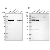 Anti-GARS antibody produced in rabbit Prestige Antibodies&#174; Powered by Atlas Antibodies, affinity isolated antibody, buffered aqueous glycerol solution