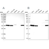 Anti-RALY antibody produced in rabbit Prestige Antibodies&#174; Powered by Atlas Antibodies, affinity isolated antibody, buffered aqueous glycerol solution