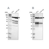 Anti-EIF4G2 antibody produced in rabbit Prestige Antibodies&#174; Powered by Atlas Antibodies, affinity isolated antibody, buffered aqueous glycerol solution, Ab1