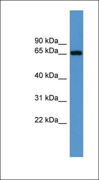 Anti-IGF2BP3 antibody produced in rabbit affinity isolated antibody