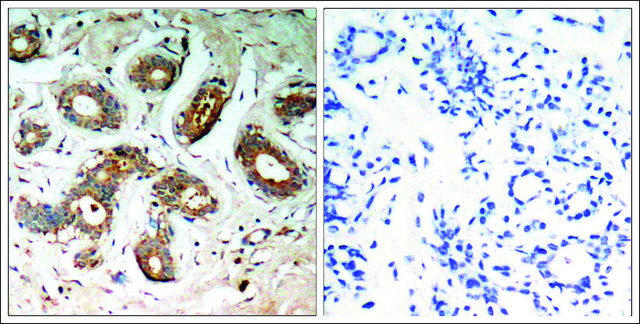 Anti-phospho-YWHAZ (pSer58) antibody produced in rabbit affinity isolated antibody