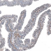 Anti-AGRN antibody produced in rabbit Prestige Antibodies&#174; Powered by Atlas Antibodies, affinity isolated antibody, buffered aqueous glycerol solution