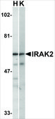 Anti-IRAK-2 antibody produced in rabbit affinity isolated antibody, buffered aqueous solution