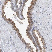 Anti-SIL1 antibody produced in rabbit Prestige Antibodies&#174; Powered by Atlas Antibodies, affinity isolated antibody, buffered aqueous glycerol solution