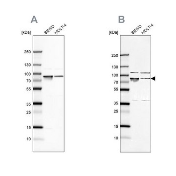 Anti-HSPA5 antibody produced in rabbit Prestige Antibodies&#174; Powered by Atlas Antibodies, affinity isolated antibody, buffered aqueous glycerol solution