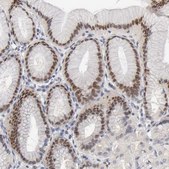 Anti-FOSL2 antibody produced in rabbit Prestige Antibodies&#174; Powered by Atlas Antibodies, affinity isolated antibody, buffered aqueous glycerol solution