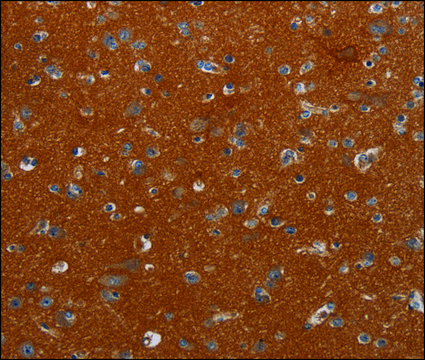 Anti-NOX3 antibody produced in rabbit affinity isolated antibody