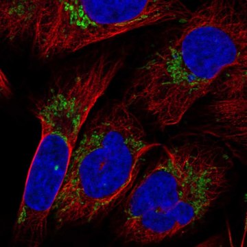 Anti-Klhl29 Antibody Produced In Rabbit Prestige Antibodies&#174; Powered by Atlas Antibodies, affinity isolated antibody, buffered aqueous glycerol solution
