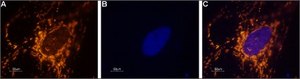 Anti-Sodium Channel, Brain Type I (&#945; subunit) antibody produced in rabbit affinity isolated antibody, lyophilized powder