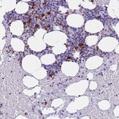 Anti-RNASE2 antibody produced in rabbit Prestige Antibodies&#174; Powered by Atlas Antibodies, affinity isolated antibody, buffered aqueous glycerol solution
