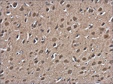 Anti-HSP70 1B antibody produced in rabbit affinity isolated antibody