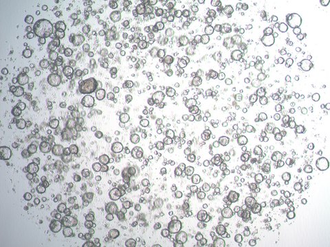 3dGRO Stomach Gastric Organoids, Age 68 (Prep ht-130-S)