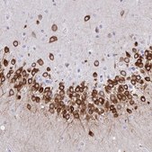 Anti-TMEM35A antibody produced in rabbit Prestige Antibodies&#174; Powered by Atlas Antibodies, affinity isolated antibody, buffered aqueous glycerol solution