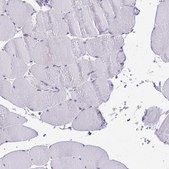 Anti-PLA2G1B antibody produced in rabbit Prestige Antibodies&#174; Powered by Atlas Antibodies, affinity isolated antibody, buffered aqueous glycerol solution