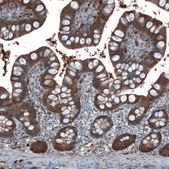 Anti-ALDH1A1 antibody produced in rabbit Prestige Antibodies&#174; Powered by Atlas Antibodies, affinity isolated antibody, buffered aqueous glycerol solution