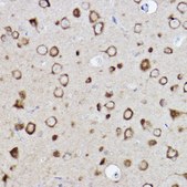 Anti-CARS Antibody, clone 7V0X1, Rabbit Monoclonal