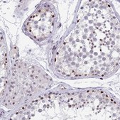 Anti-WDR72 antibody produced in rabbit Prestige Antibodies&#174; Powered by Atlas Antibodies, affinity isolated antibody, buffered aqueous glycerol solution