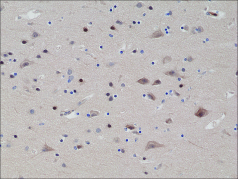 Anti-PTEN antibody, Rabbit monoclonal recombinant, expressed in HEK 293 cells, clone RM265, purified immunoglobulin