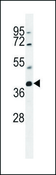 ANTI-SRD5A2L2 (C-TERM) antibody produced in rabbit IgG fraction of antiserum, buffered aqueous solution