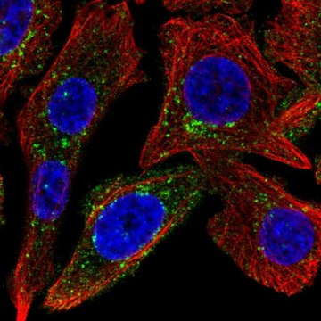 Anti-SPRY4 antibody produced in rabbit Prestige Antibodies&#174; Powered by Atlas Antibodies, affinity isolated antibody