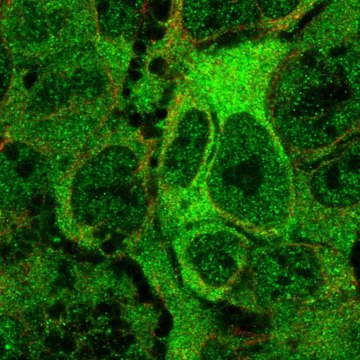Anti-ANKMY2 antibody produced in rabbit Prestige Antibodies&#174; Powered by Atlas Antibodies, affinity isolated antibody