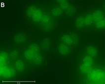 Anti-RAR&#947;1 Antibody, clone 1C22 ZooMAb&#174; Rabbit Monoclonal recombinant, expressed in HEK 293 cells