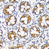 Anti-TOMM22 Antibody, clone 6R1L7, Rabbit Monoclonal