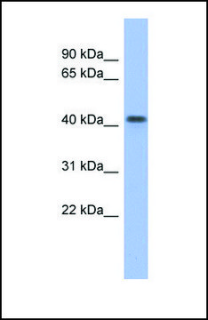 Anti-FIZ1 antibody produced in rabbit affinity isolated antibody