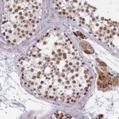 Anti-EED antibody produced in rabbit Prestige Antibodies&#174; Powered by Atlas Antibodies, affinity isolated antibody, buffered aqueous glycerol solution
