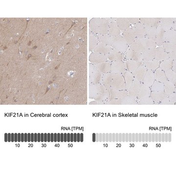 Anti-KIF21A antibody produced in rabbit Prestige Antibodies&#174; Powered by Atlas Antibodies, affinity isolated antibody, buffered aqueous glycerol solution