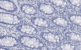 Anti-Na+-K+ ATPase &#945;1 Antibody, clone 1E13 ZooMAb&#174; Rabbit Monoclonal recombinant, expressed in HEK 293 cells