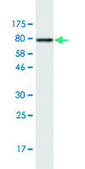 Monoclonal Anti-KRT6B antibody produced in mouse clone 1C12, purified immunoglobulin, buffered aqueous solution