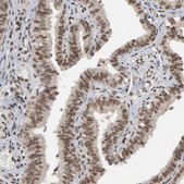Anti-ZNF384 antibody produced in rabbit Prestige Antibodies&#174; Powered by Atlas Antibodies, affinity isolated antibody, buffered aqueous glycerol solution