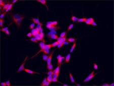 Anti-ZNF746 antibody produced in rabbit ~1.0&#160;mg/mL, affinity isolated antibody