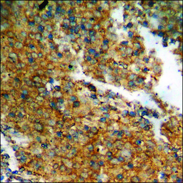 Anti-phospho-Catenin-&#946; (pThr41/Ser45) antibody produced in rabbit affinity isolated antibody