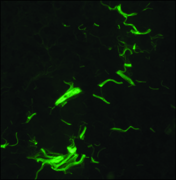 Anti-Collagen Type I antibody, Mouse monoclonal clone COL-1, purified from hybridoma cell culture