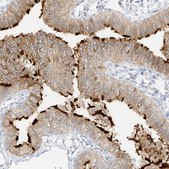 Anti-DCDC2 antibody produced in rabbit Prestige Antibodies&#174; Powered by Atlas Antibodies, affinity isolated antibody, buffered aqueous glycerol solution