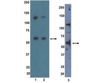 Anti-ALK7 Antibody Upstate&#174;, from rabbit