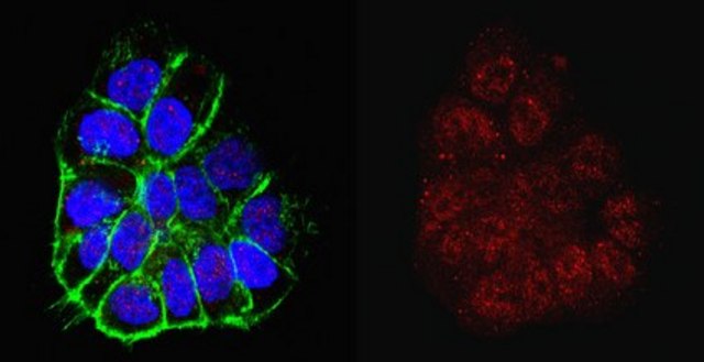 Anti-TERT Antibody from rabbit, purified by affinity chromatography