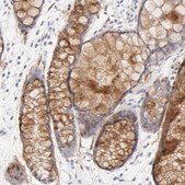 Anti-NPNT antibody produced in rabbit Prestige Antibodies&#174; Powered by Atlas Antibodies, affinity isolated antibody, buffered aqueous glycerol solution
