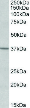 Anti-S1PR2 antibody produced in goat affinity isolated antibody, buffered aqueous solution