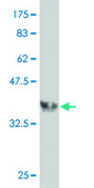 Monoclonal Anti-PPP3R2 antibody produced in mouse clone 5D9, purified immunoglobulin, buffered aqueous solution