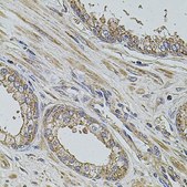Anti-ALIX/PDCD6IP antibody produced in rabbit