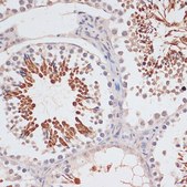Anti-CDKN2A/p16INK4a antibody produced in rabbit
