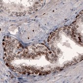 Monoclonal Anti-LMNB1 antibody produced in mouse Prestige Antibodies&#174; Powered by Atlas Antibodies, clone CL3929, purified immunoglobulin, buffered aqueous glycerol solution