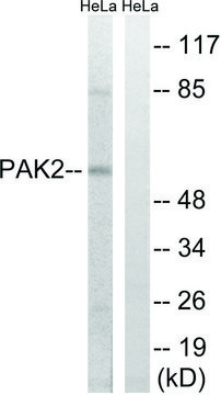 Anti-PAK2 antibody produced in rabbit affinity isolated antibody